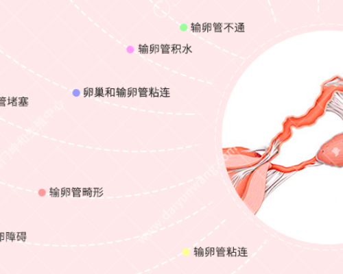 试管婴儿促排之腹水问题：解析与预防之道