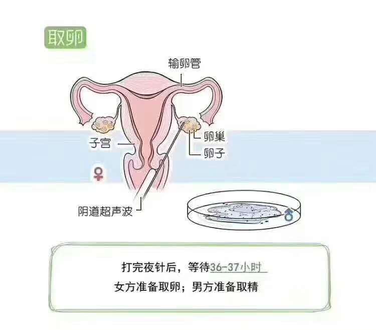 听说去香港验血不一定准,一分钟看懂试管婴儿全过程，太辛苦了，试管妈妈当